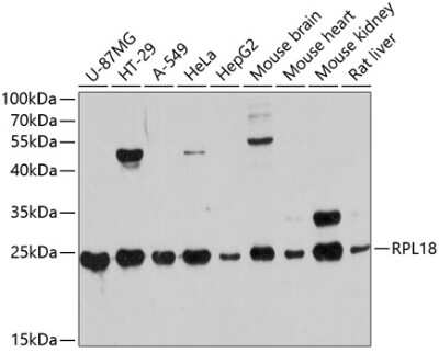 Western Blot: RPL18 Antibody [NBP2-94208] - Western blot analysis of extracts of various cell lines, using RPL18 antibody (NBP2-94208) at 1:3000 dilution. Secondary antibody: HRP Goat Anti-Rabbit IgG (H+L) at 1:10000 dilution. Lysates/proteins: 25ug per lane. Blocking buffer: 3% nonfat dry milk in TBST. Detection: ECL Basic Kit. Exposure time: 60s.